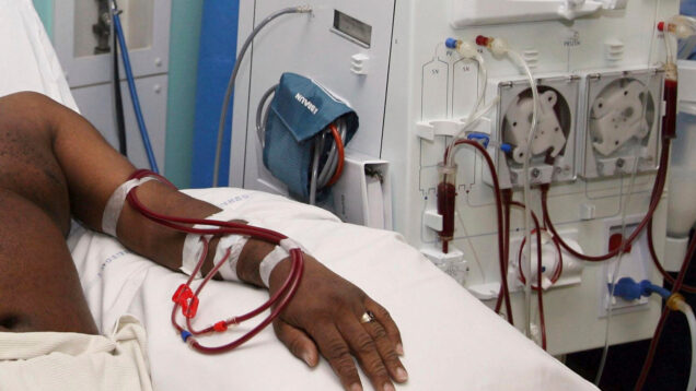 Kidney-dialysis-636x424-1 - Accra Daily Post dialysis machine
